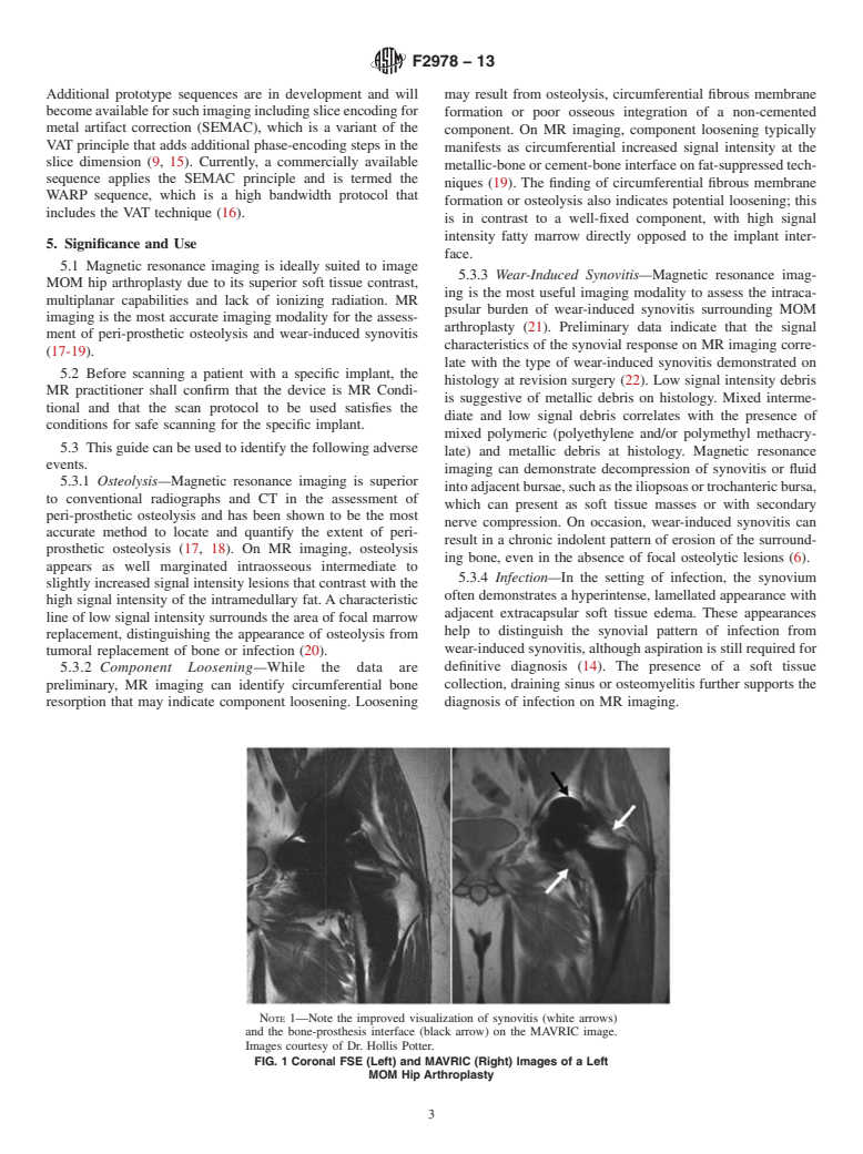 ASTM F2978-13 - Guide to Optimize Scan Sequences for Clinical Diagnostic Evaluation  of Metal-on-Metal Hip Arthroplasty Devices using Magnetic Resonance  Imaging